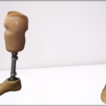 podkoljena proteza